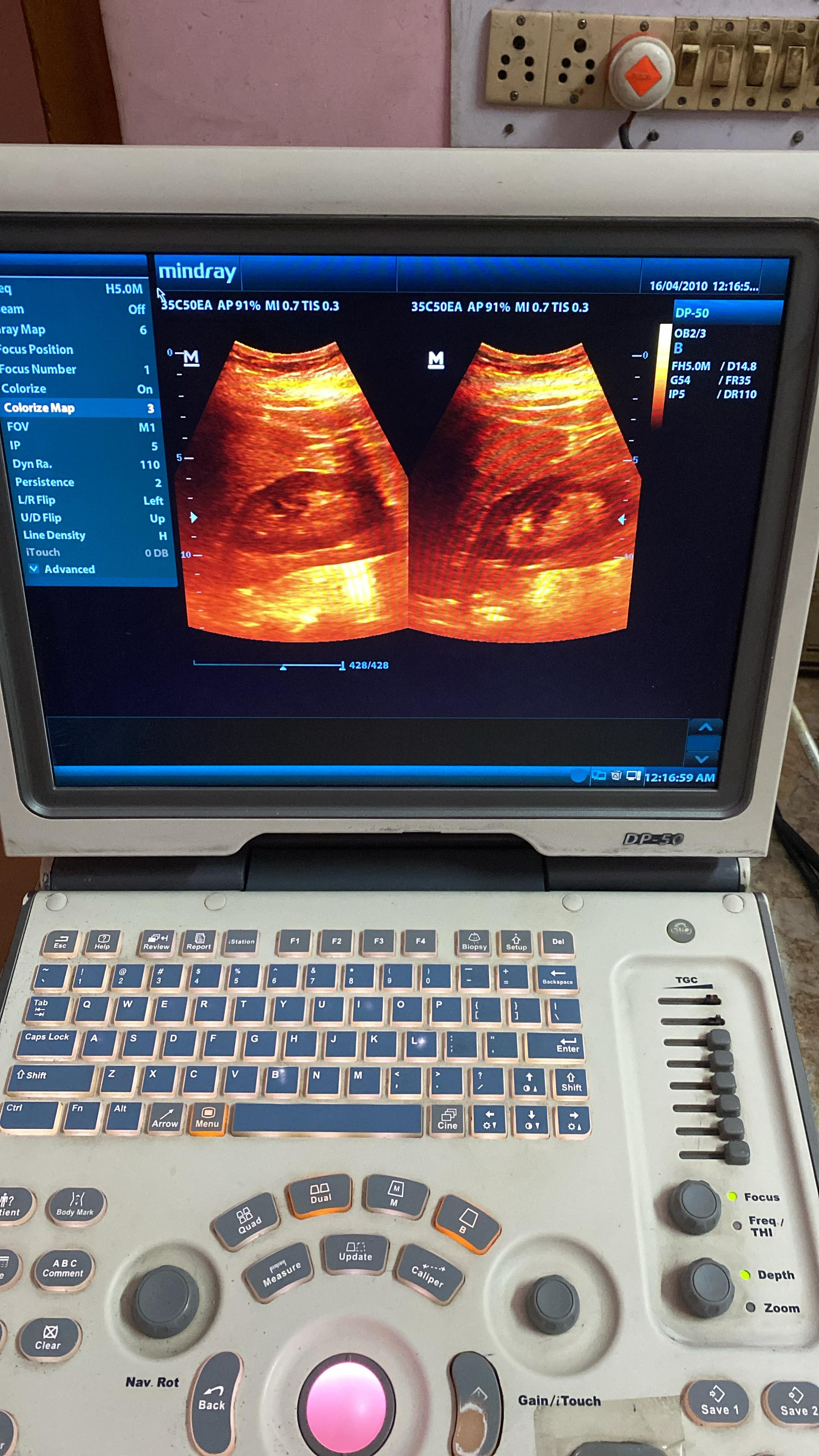 Mindray DP50